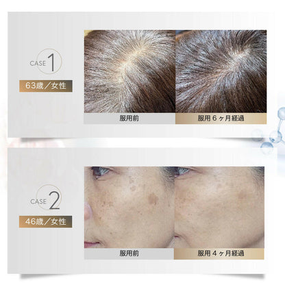 【定期便（1ヶ月コース）】5デアザフラビン TND1128