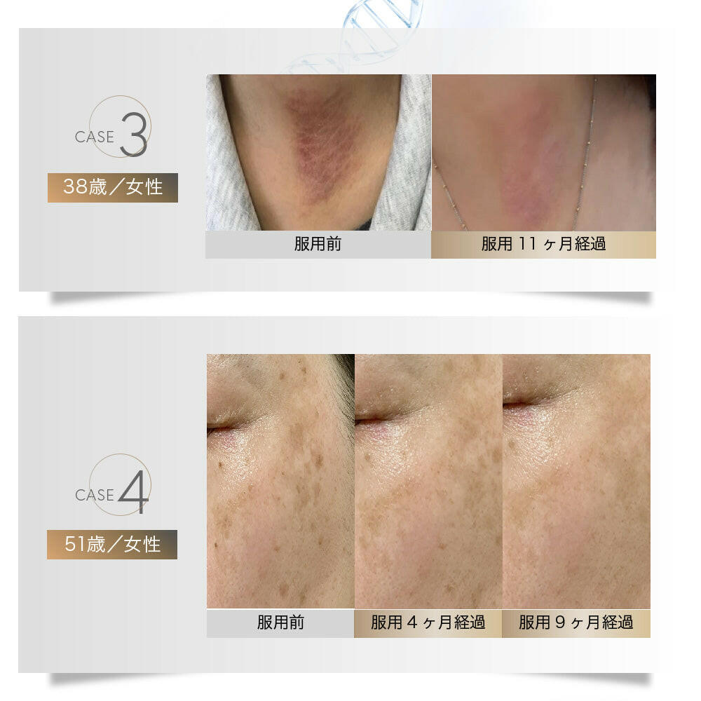 【定期便（1ヶ月コース）】5デアザフラビン TND1128