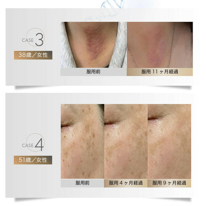 【定期便（1ヶ月コース）】5デアザフラビン TND1128