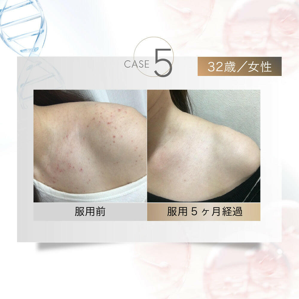 【定期便（1ヶ月コース）】5デアザフラビン TND1128