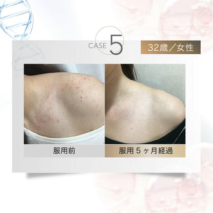 【定期便（1ヶ月コース）】5デアザフラビン TND1128